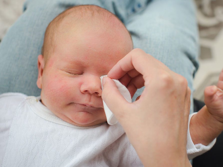 Yenidoğan ve bir yaşındaki bebeklere göz kontrolü şart